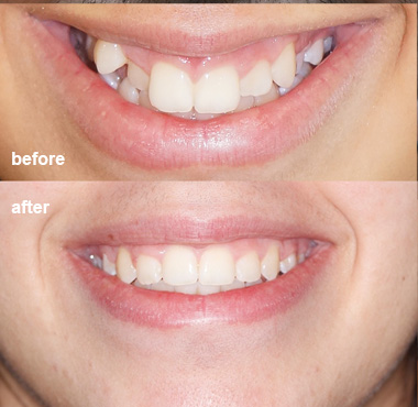before and after 7