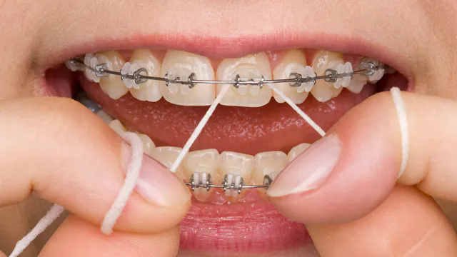 Flossing
