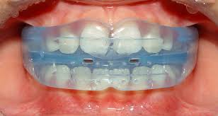 myobrace